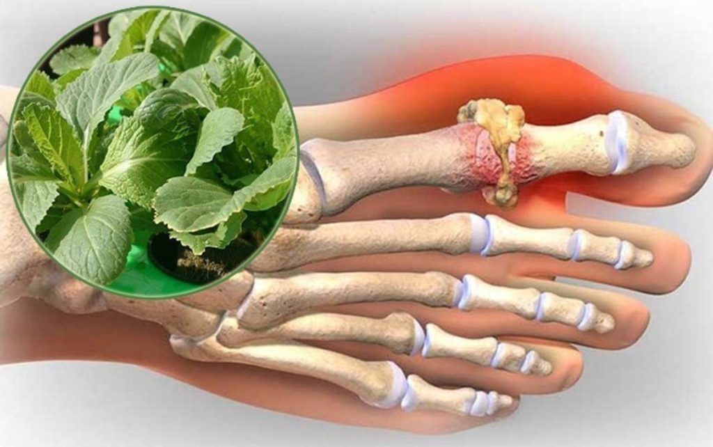 Cải Bẹ Xanh Trị Bệnh Gout: Bí Quyết Tự Nhiên Bạn Nên Thử