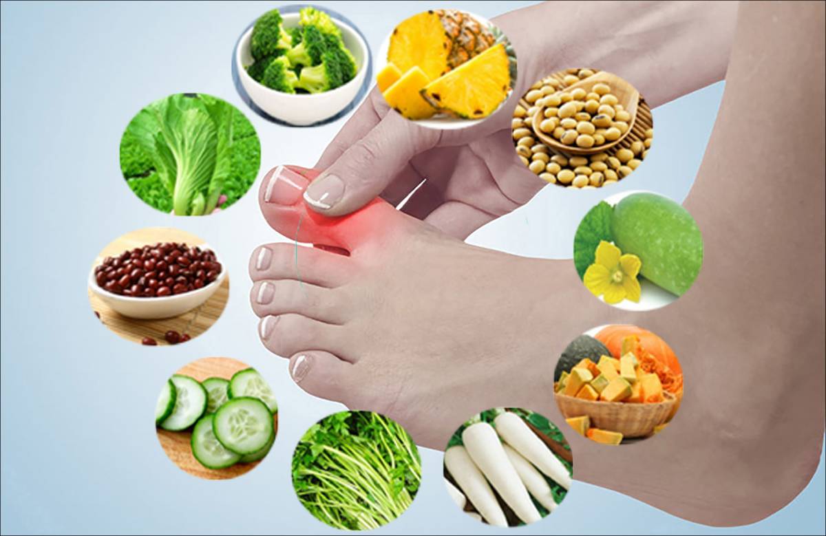 Những thực phẩm thay thế tốt cho người bị gout