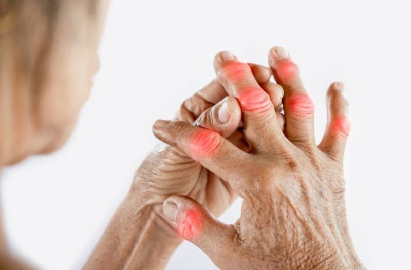 Hiểu đúng về bệnh gout và nguyên nhân gây biến dạng tay chân